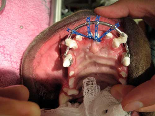 Orthhodontics